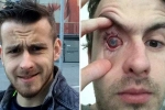 why can't you wear contact lenses in the shower?, contact lens wearers, contact lens wearers beware man goes blind after parasites eat man s eye as he wore lenses in shower, Eyesight