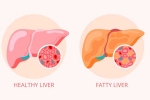Grade 2 Fatty Liver symptoms, Grade 2 Fatty Liver experts, how to reverse grade 2 fatty liver, Fatty liver disease Grade 2 Fatty Liver symptoms, Grade 2 Fatty Liver experts, how to reverse grade 2 fatty liver, Fatty liver disease