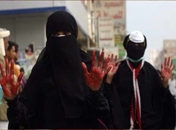 'Dead woman' comes alive in Yemen!