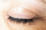 Eyelash Dandruff updates, Eyelash Dandruff symptoms, all about eyelash dandruff, Eye make up